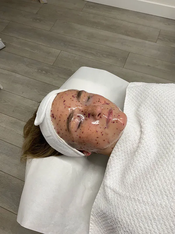 Facials and Chemical Peels
