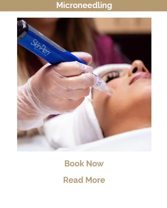 Microneedling treatment Victoria