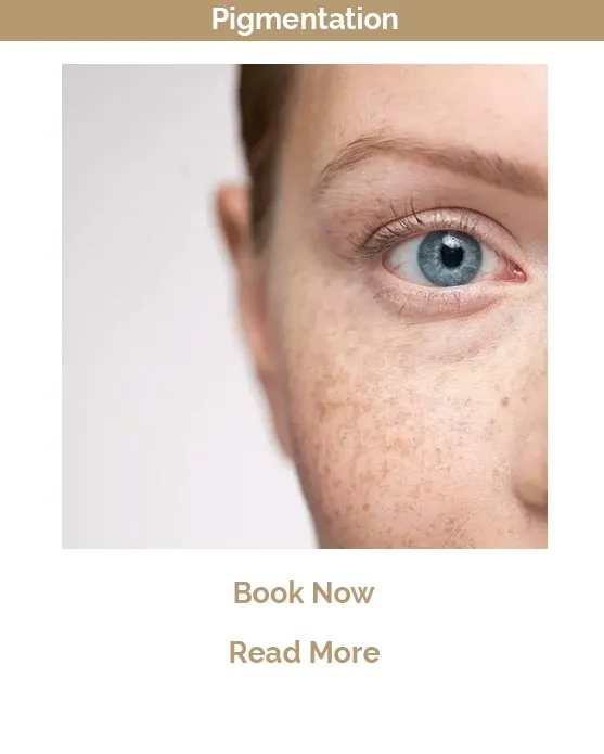 Pigmentation treatment Victoria